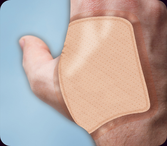 Wound photo